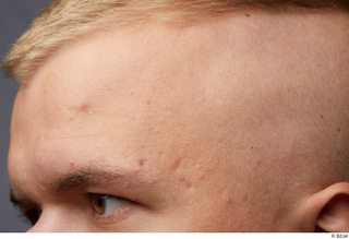 HD Face Skin Jerome face forehead head skin pores skin…